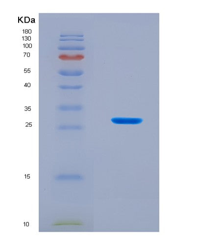SDS-PAGE analysis of Human GPX3 (Glutathione Peroxidase 3) - Recombinant Protein, CAT# BLT-08916P showing >90% purity under 15% SDS-PAGE (Reduced)