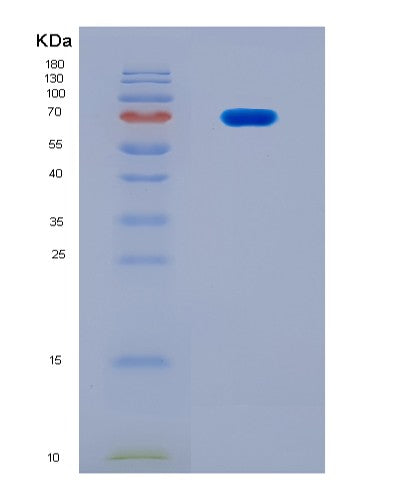 SDS-PAGE analysis of Human NFIC (Nuclear Factor 1 C-Type) - Recombinant Protein, CAT# BLT-08918P showing >90% purity under 15% SDS-PAGE (Reduced)