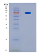 SDS-PAGE analysis of Human NFIC (Nuclear Factor 1 C-Type) - Recombinant Protein, CAT# BLT-08918P showing >90% purity under 15% SDS-PAGE (Reduced)