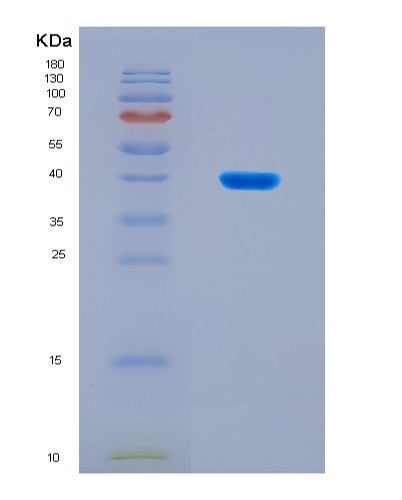 SDS-PAGE analysis of Mouse Bglap (Osteocalcin) - Recombinant Protein, CAT# BLT-08921P showing >90% purity under 15% SDS-PAGE (Reduced)