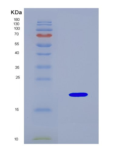 SDS-PAGE analysis of Mouse Reg4 (Regenerating Islet-Derived Protein 4) - Recombinant Protein, CAT# BLT-08923P showing >90% purity under 15% SDS-PAGE (Reduced)