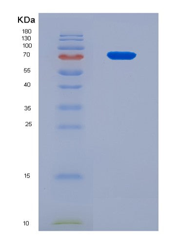 SDS-PAGE analysis of Human KRT7 (Keratin, Type Ii Cytoskeletal 7) - Recombinant Protein, CAT# BLT-08925P showing >90% purity under 15% SDS-PAGE (Reduced)