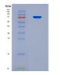 SDS-PAGE analysis of Human KRT7 (Keratin, Type Ii Cytoskeletal 7) - Recombinant Protein, CAT# BLT-08925P showing >90% purity under 15% SDS-PAGE (Reduced)