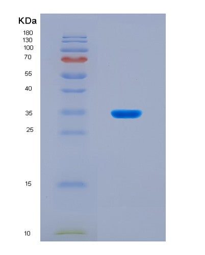 SDS-PAGE analysis of Mouse Hmox1 (Heme Oxygenase 1) - Recombinant Protein, CAT# BLT-08926P showing >90% purity under 15% SDS-PAGE (Reduced)
