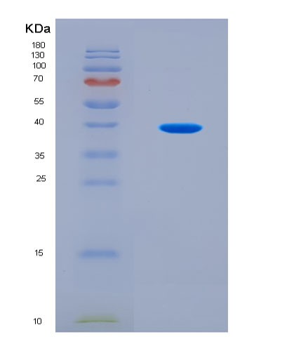 SDS-PAGE analysis of Mouse Rab27a (Ras-Related Protein Rab-27A) - Recombinant Protein, CAT# BLT-08929P showing >90% purity under 15% SDS-PAGE (Reduced)