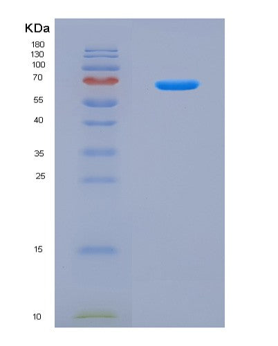 SDS-PAGE analysis of Mouse Vps4a (Vacuolar Protein Sorting-Associated Protein 4A) - Recombinant Protein, CAT# BLT-08930P showing >90% purity under 15% SDS-PAGE (Reduced)