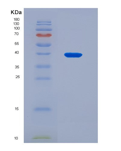 SDS-PAGE analysis of Mouse Rab5a (Ras-Related Protein Rab-5A) - Recombinant Protein, CAT# BLT-08931P showing >90% purity under 15% SDS-PAGE (Reduced)