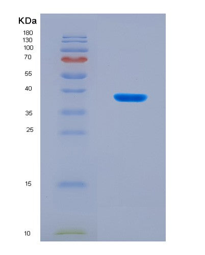 SDS-PAGE analysis of Mouse Rab7a (Ras-Related Protein Rab-7A) - Recombinant Protein, CAT# BLT-08932P showing >90% purity under 15% SDS-PAGE (Reduced)
