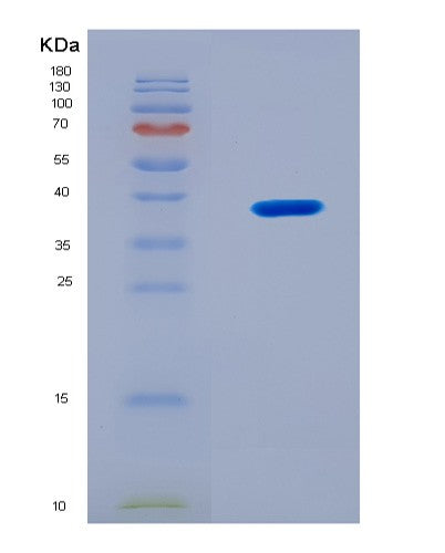 SDS-PAGE analysis of Mouse Rab35 (Ras-Related Protein Rab-35) - Recombinant Protein, CAT# BLT-08933P showing >90% purity under 15% SDS-PAGE (Reduced)