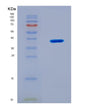 SDS-PAGE analysis of Mouse Rab35 (Ras-Related Protein Rab-35) - Recombinant Protein, CAT# BLT-08933P showing >90% purity under 15% SDS-PAGE (Reduced)