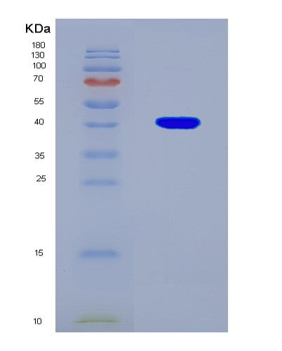 SDS-PAGE analysis of Human RAF1 (Raf Proto-Oncogene Serine/Threonine-Protein Kinase) - Recombinant Protein, CAT# BLT-08935P showing >90% purity under 15% SDS-PAGE (Reduced)