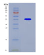 SDS-PAGE analysis of Human RAF1 (Raf Proto-Oncogene Serine/Threonine-Protein Kinase) - Recombinant Protein, CAT# BLT-08935P showing >90% purity under 15% SDS-PAGE (Reduced)