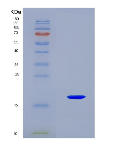 SDS-PAGE analysis of Human ANGPT2 (Angiopoietin-2) - Recombinant Protein, CAT# BLT-08937P showing >90% purity under 15% SDS-PAGE (Reduced)