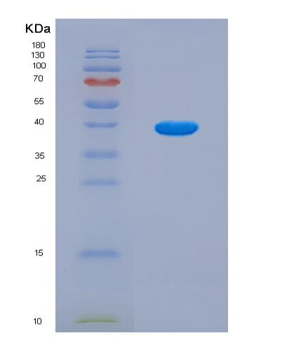 SDS-PAGE analysis of Human MT-ND1 (Nadh-Ubiquinone Oxidoreductase Chain 1) - Recombinant Protein, CAT# BLT-08938P showing >90% purity under 15% SDS-PAGE (Reduced)