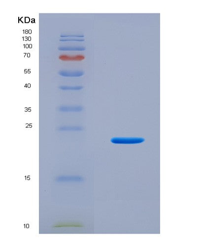 SDS-PAGE analysis of Human MB (Myoglobin) - Recombinant Protein, CAT# BLT-08942P showing >90% purity under 15% SDS-PAGE (Reduced)