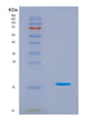 SDS-PAGE analysis of Human FABP3 (Fatty Acid-Binding Protein, Heart) - Recombinant Protein, CAT# BLT-08943P showing >90% purity under 15% SDS-PAGE (Reduced)