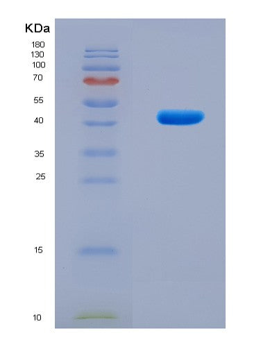 SDS-PAGE analysis of Human SNRPA (U1 Small Nuclear Ribonucleoprotein A) - Recombinant Protein, CAT# BLT-08852P showing >90% purity under 15% SDS-PAGE (Reduced)