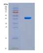 SDS-PAGE analysis of Human SNRPA (U1 Small Nuclear Ribonucleoprotein A) - Recombinant Protein, CAT# BLT-08852P showing >90% purity under 15% SDS-PAGE (Reduced)