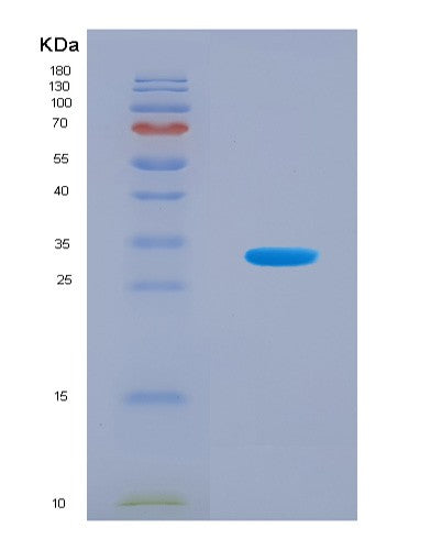 SDS-PAGE analysis of Human SNRPC (U1 Small Nuclear Ribonucleoprotein C) - Recombinant Protein, CAT# BLT-08853P showing >90% purity under 15% SDS-PAGE (Reduced)