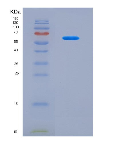 SDS-PAGE analysis of Human RNASE3 (Eosinophil Cationic Protein) - Recombinant Protein, CAT# BLT-08816P showing >90% purity under 15% SDS-PAGE (Reduced)