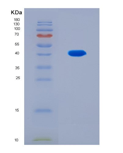 SDS-PAGE analysis of Human ITPR3 (Inositol 1,4,5-Trisphosphate-Gated Calcium Channel Itpr3) - Recombinant Protein, CAT# BLT-08914P showing >90% purity under 15% SDS-PAGE (Reduced)