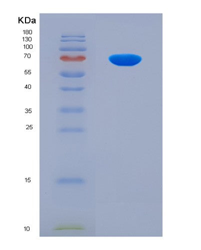 SDS-PAGE analysis of Human YAP1 (Transcriptional Coactivator Yap1) - Recombinant Protein, CAT# BLT-08640P showing >90% purity under 15% SDS-PAGE (Reduced)