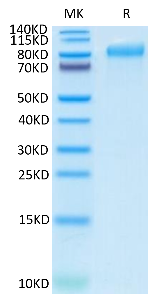 Human ITGB6 on Tris-Bis PAGE under reduced condition. The purity is greater than 95%.