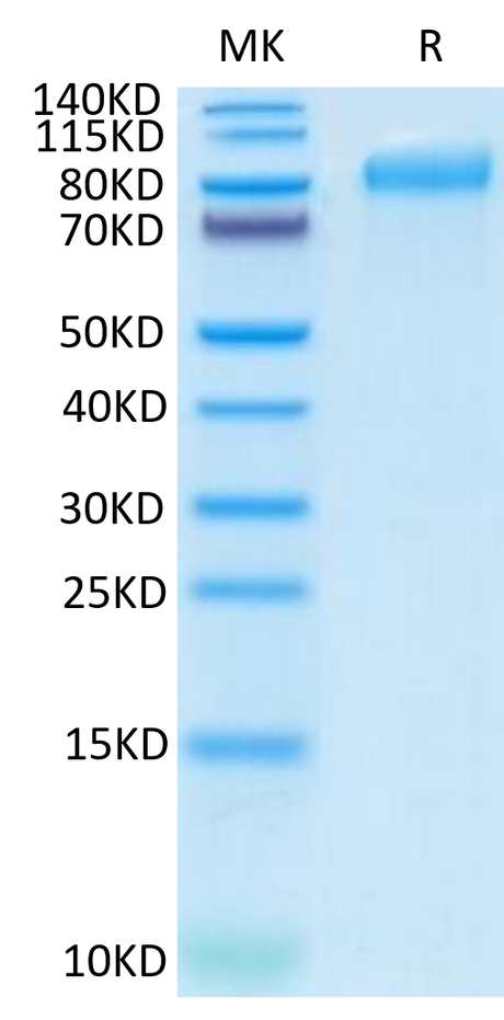 Human ITGB6 on Tris-Bis PAGE under reduced condition. The purity is greater than 95%.