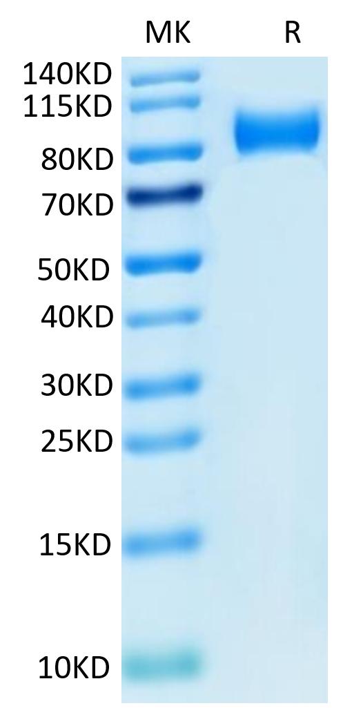 Mouse ITGB6 on Tris-Bis PAGE under reduced condition. The purity is greater than 95%.