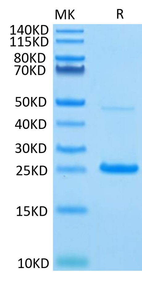 Human IL-17C on Tris-Bis PAGE under reduced condition. The purity is greater than 95%.