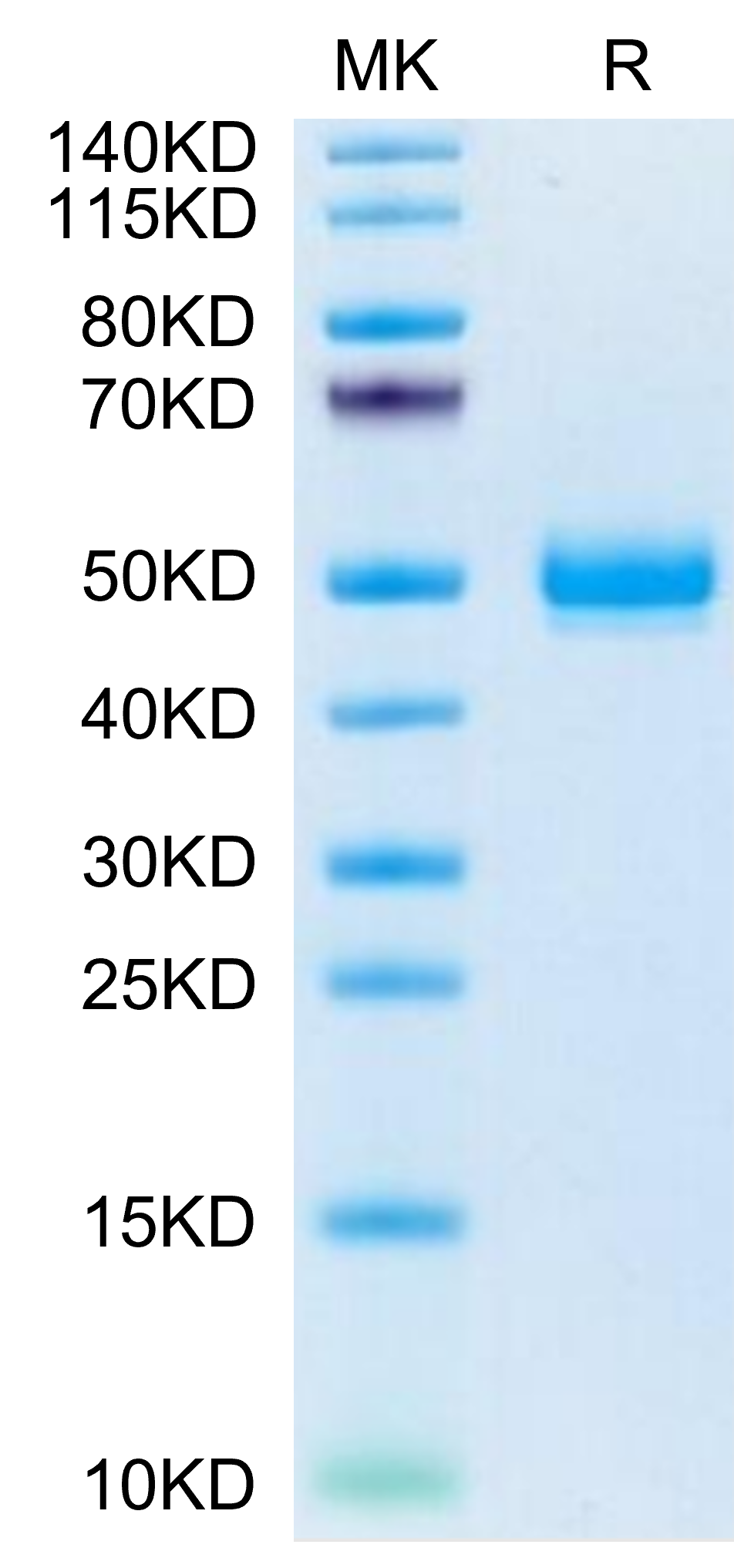 Mouse EPHA5 on Tris-Bis PAGE under reduced condition. The purity is greater than 95%.