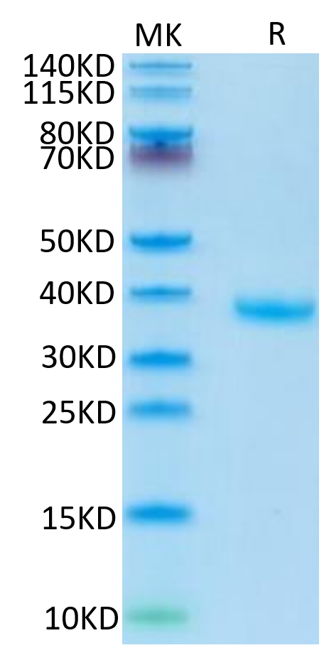 Human FSTL3 on Tris-Bis PAGE under reduced condition. The purity is greater than 95%.