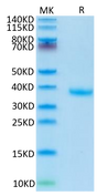 Human FSTL3 on Tris-Bis PAGE under reduced condition. The purity is greater than 95%.