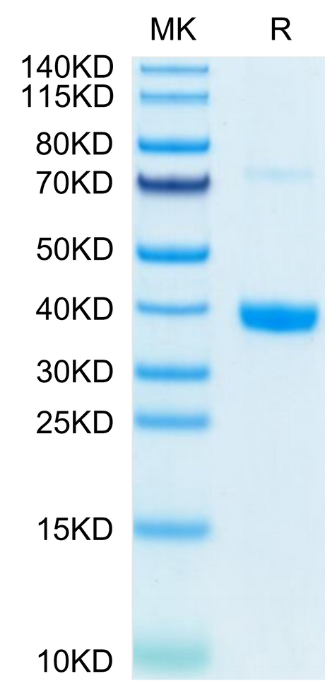 Mouse MFAP4 on Tris-Bis PAGE under reduced condition. The purity is greater than 95%.