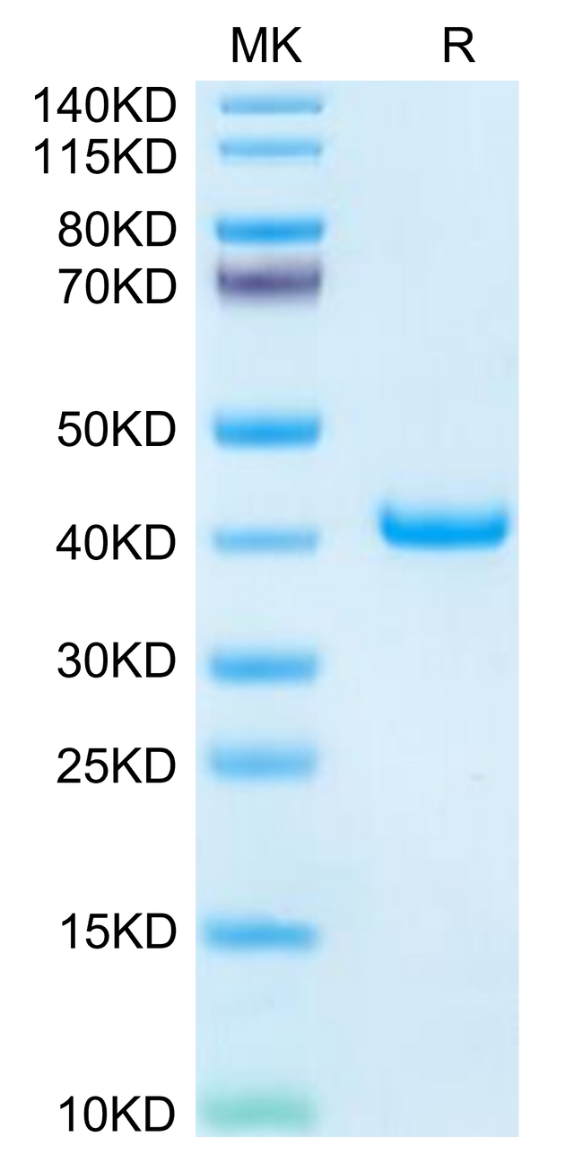 Mouse TFF1 on Tris-Bis PAGE under reduced condition. The purity is greater than 95%.