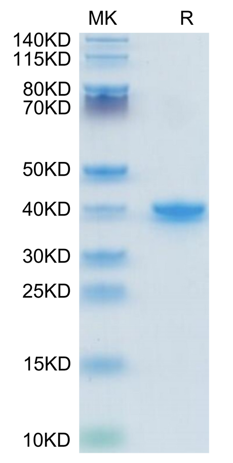 Mouse TGF-alpha on Tris-Bis PAGE under reduced condition. The purity is greater than 95%.