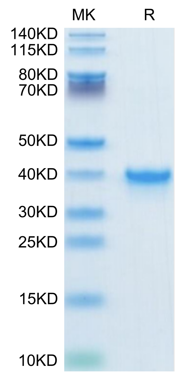 Human TGF-alpha on Tris-Bis PAGE under reduced condition. The purity is greater than 95%.