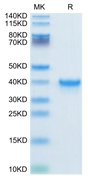 Human TGF-alpha on Tris-Bis PAGE under reduced condition. The purity is greater than 95%.