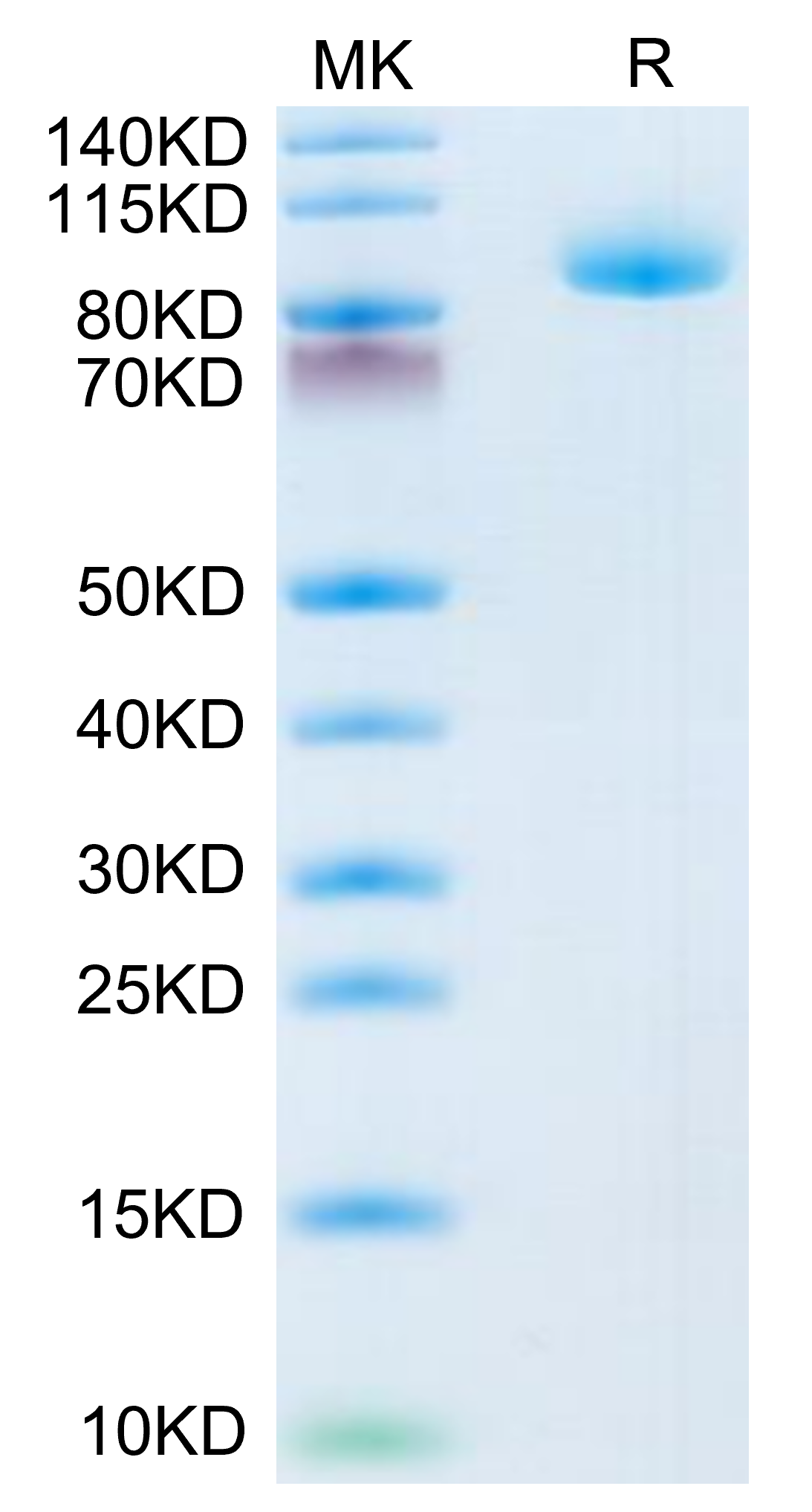 Human LRIG1 on Tris-Bis PAGE under reduced condition. The purity is greater than 95%.