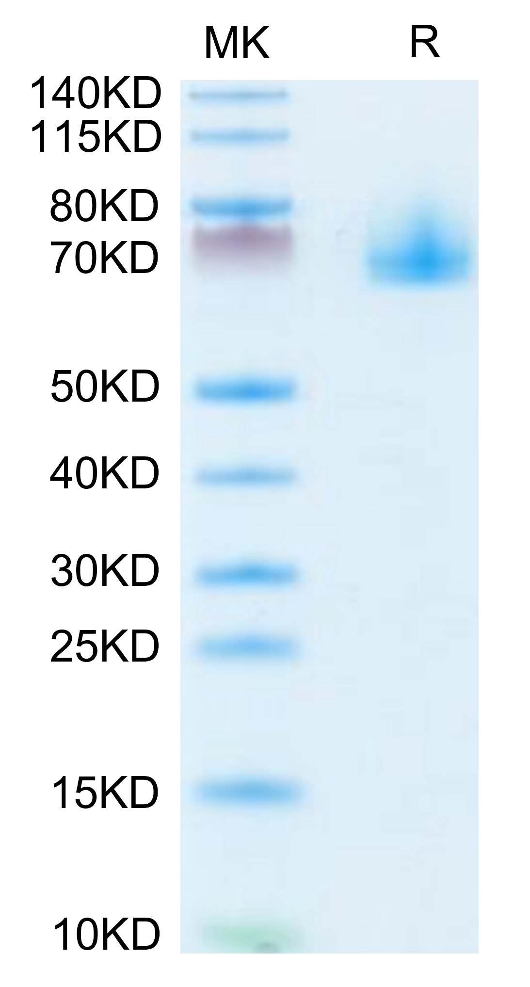 Mouse EPHA10 on Tris-Bis PAGE under reduced condition. The purity is greater than 95%.