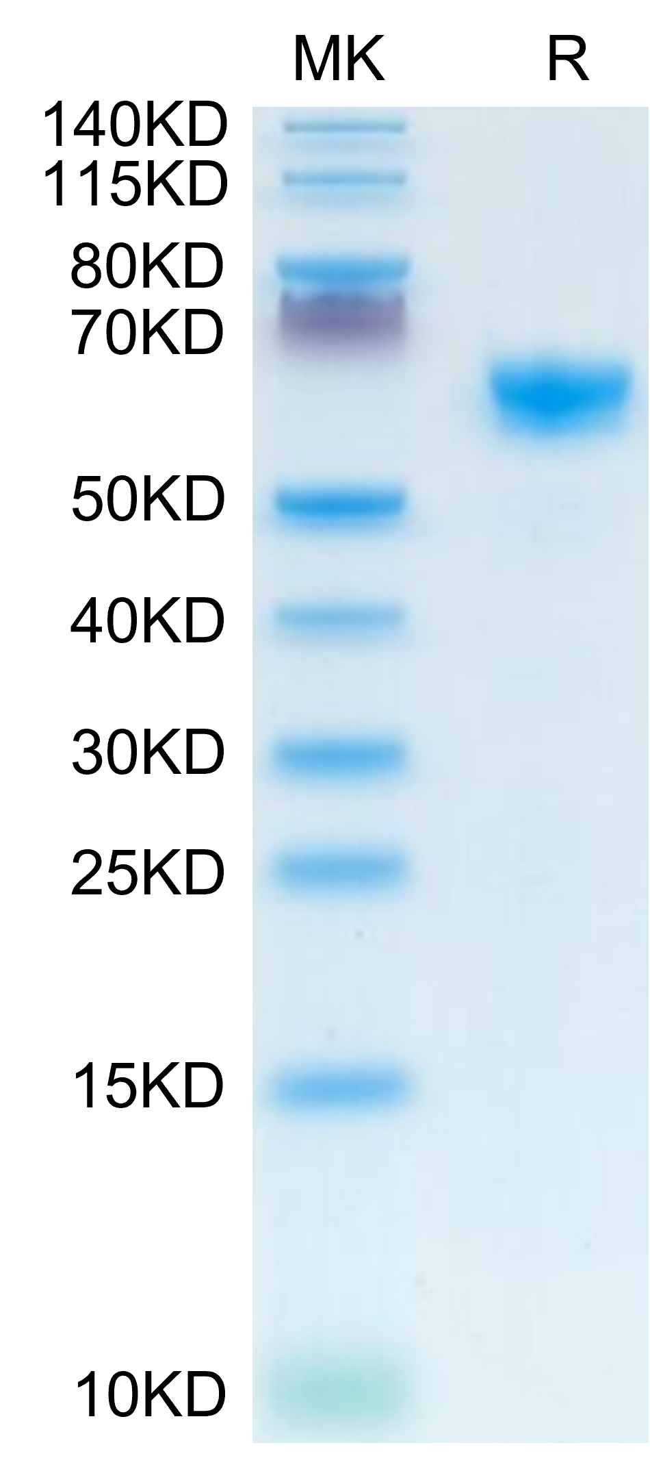 Mouse IGFBP-3R on Tris-Bis PAGE under reduced condition. The purity is greater than 95%.