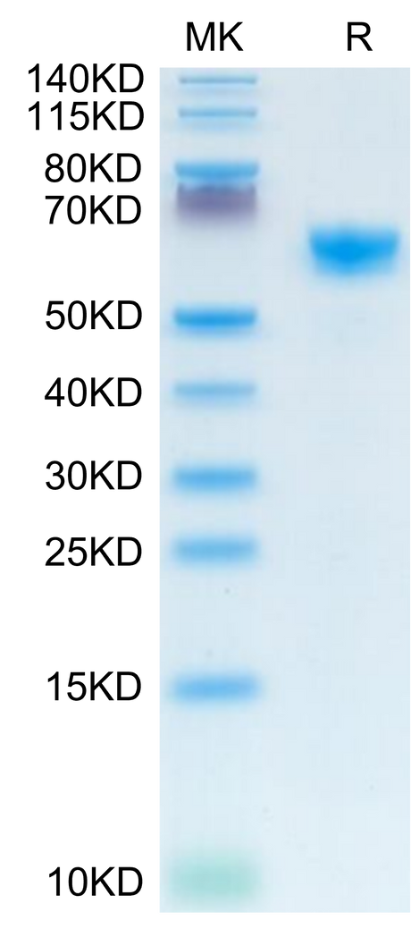 Mouse IGFBP-3R on Tris-Bis PAGE under reduced condition. The purity is greater than 95%.