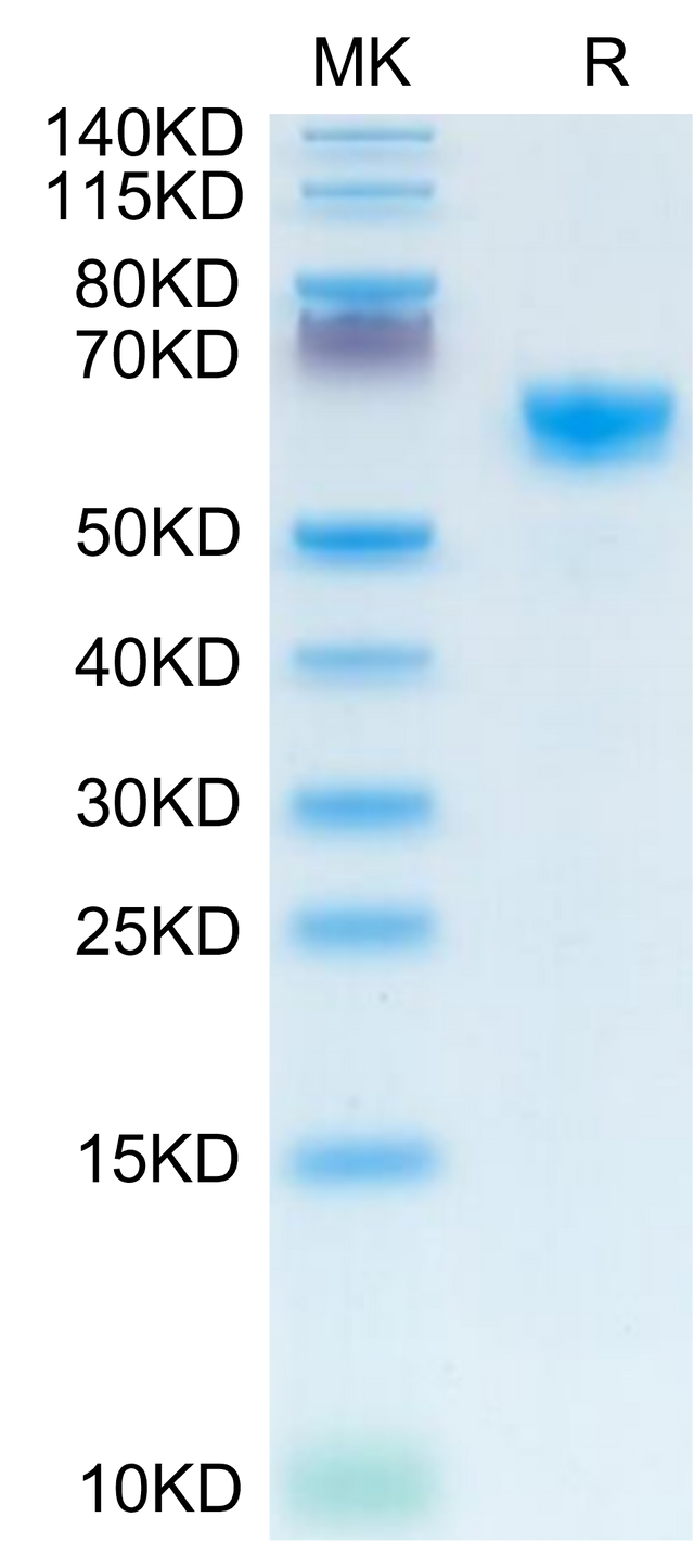Mouse IGFBP-3R on Tris-Bis PAGE under reduced condition. The purity is greater than 95%.