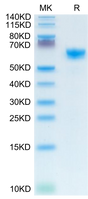 Mouse IGFBP-3R on Tris-Bis PAGE under reduced condition. The purity is greater than 95%.