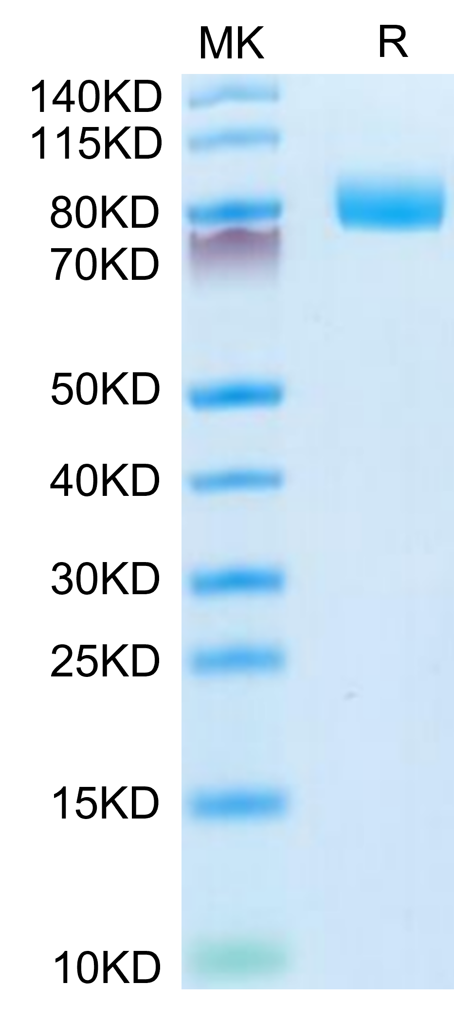 Mouse CD10 on Tris-Bis PAGE under reduced condition. The purity is greater than 95%.
