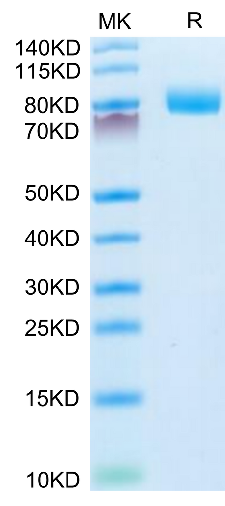 Mouse CD10 on Tris-Bis PAGE under reduced condition. The purity is greater than 95%.