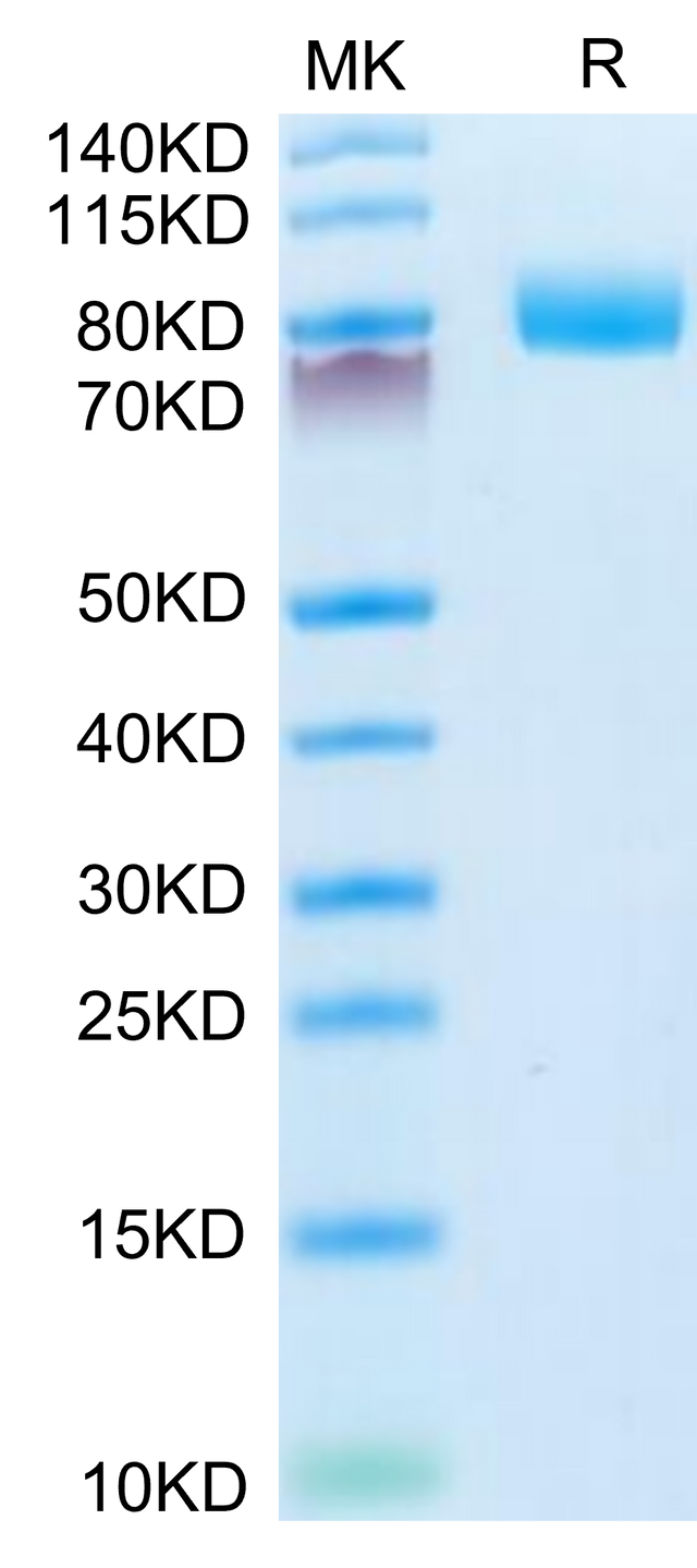 Mouse CD10 on Tris-Bis PAGE under reduced condition. The purity is greater than 95%.