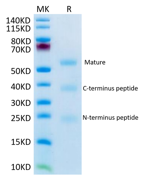 Mouse RGM-C on Tris-Bis PAGE under reduced condition. The purity is greater than 95%.