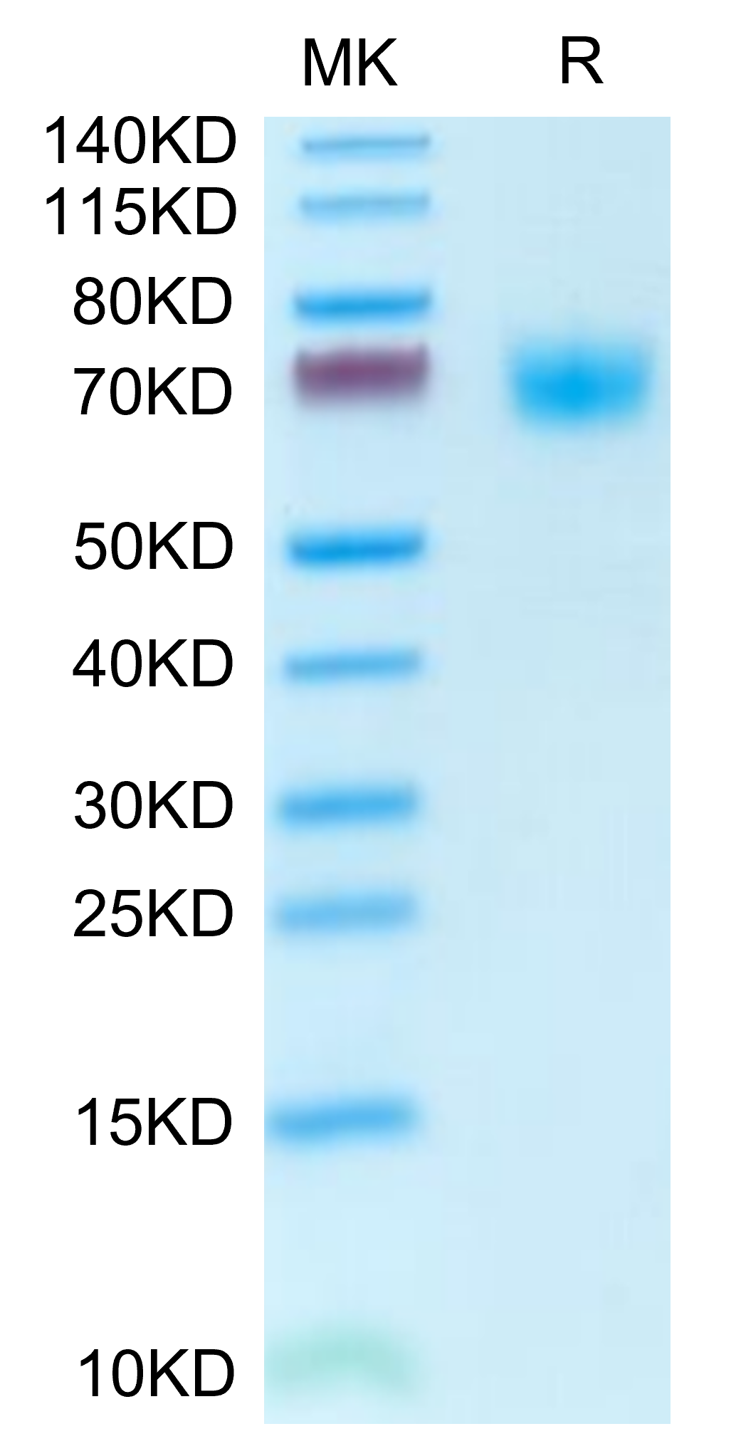 Mouse PLD4 on Tris-Bis PAGE under reduced condition. The purity is greater than 95%.