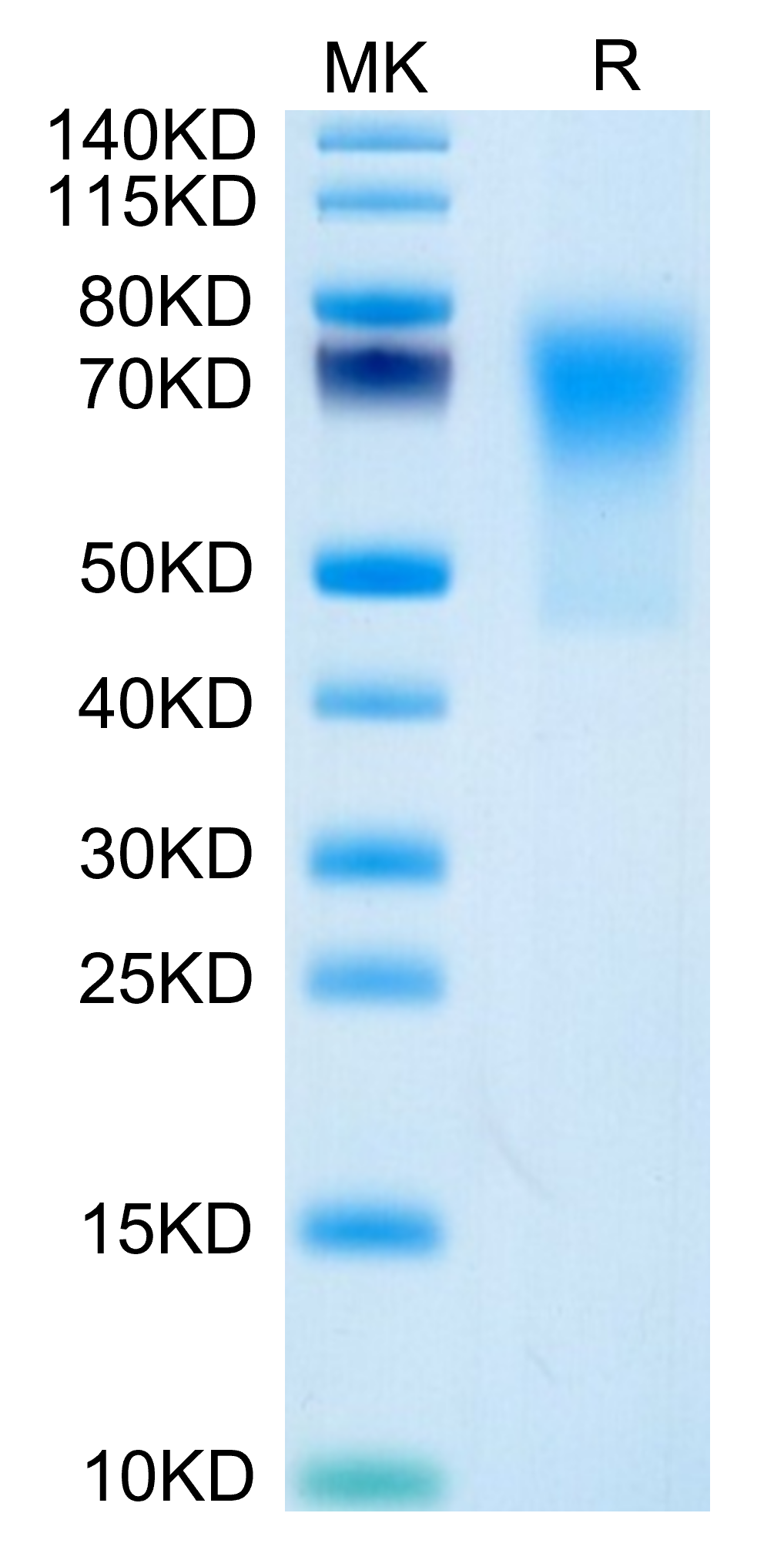 Human DcR1/TRAILR3 on Tris-Bis PAGE under reduced condition. The purity is greater than 95%.